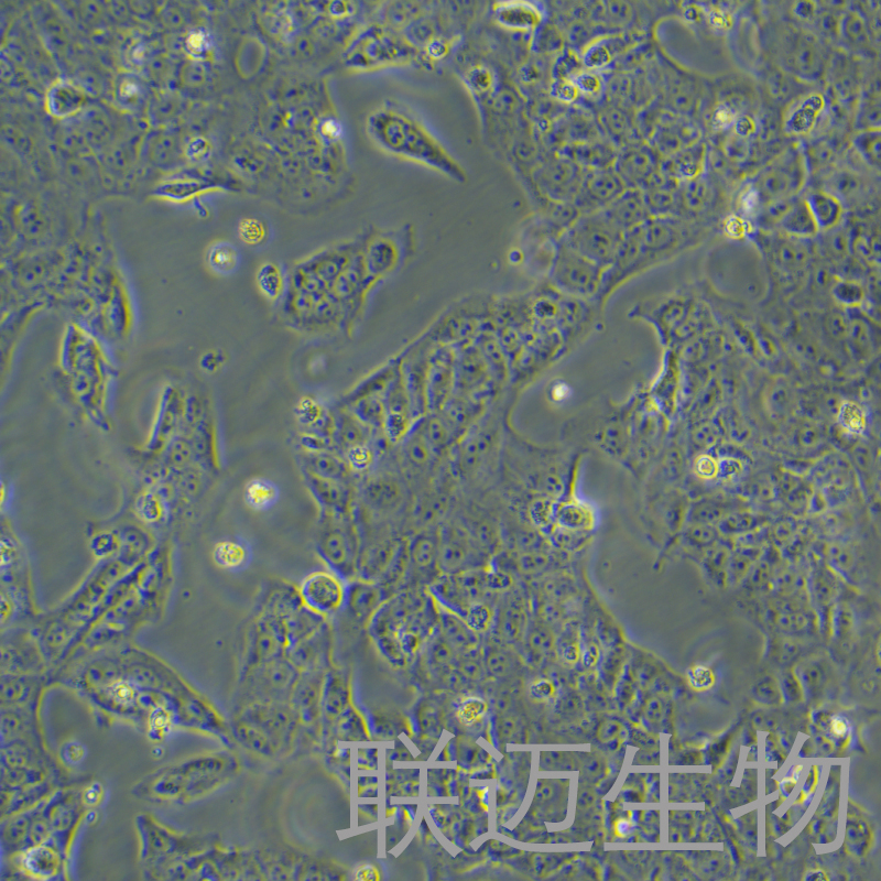 JEG-3细胞（绒毛膜癌细胞STR鉴定正确）LM8C0127