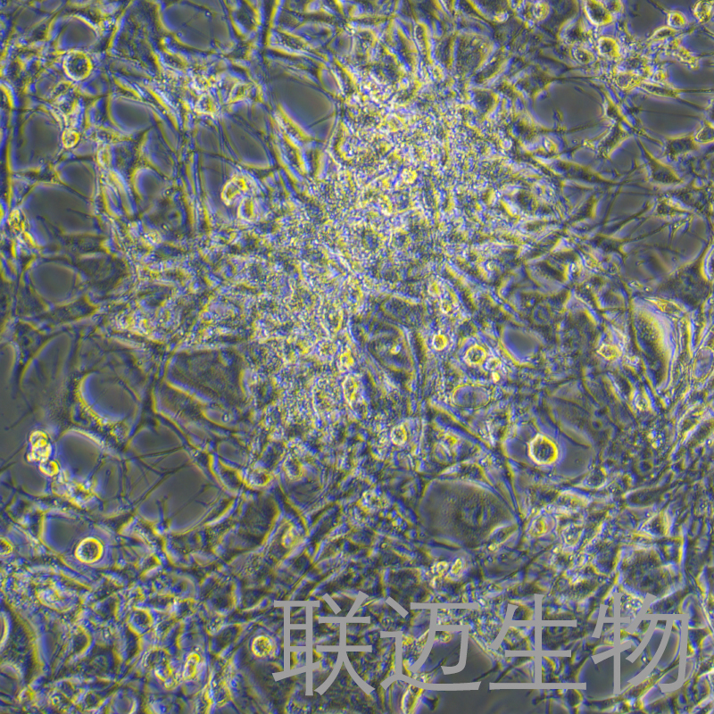 OP9细胞（小鼠骨髓基质细胞）LM8C0176