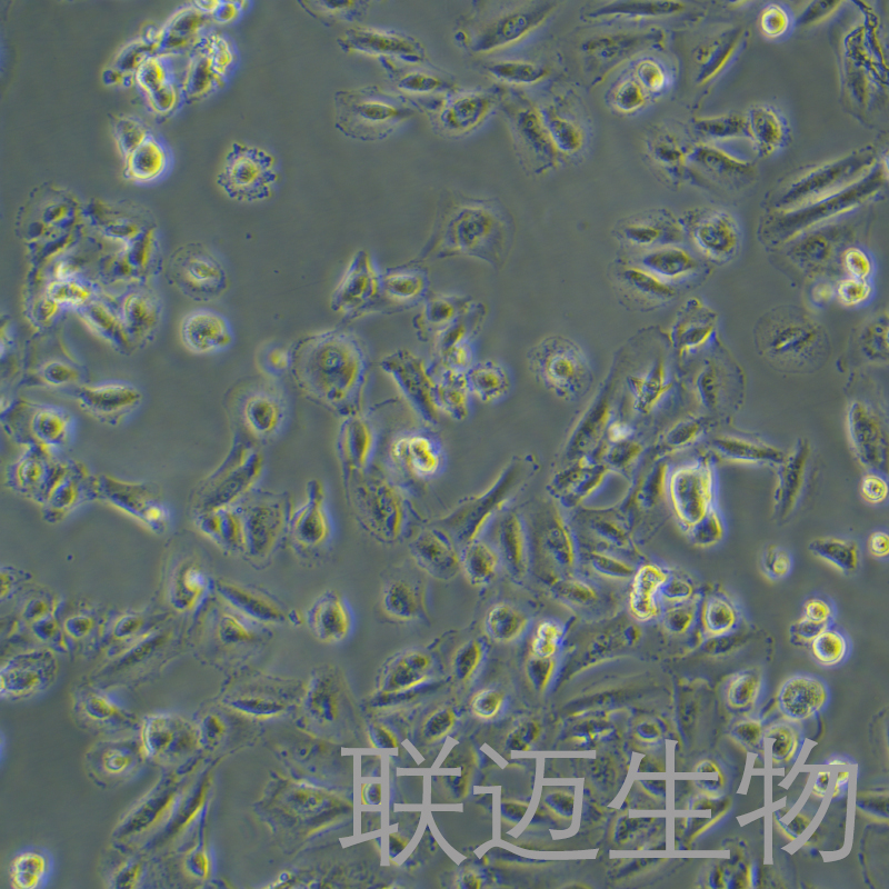 OS-RC-2细胞（肾癌细胞STR鉴定正确）LM8C0188