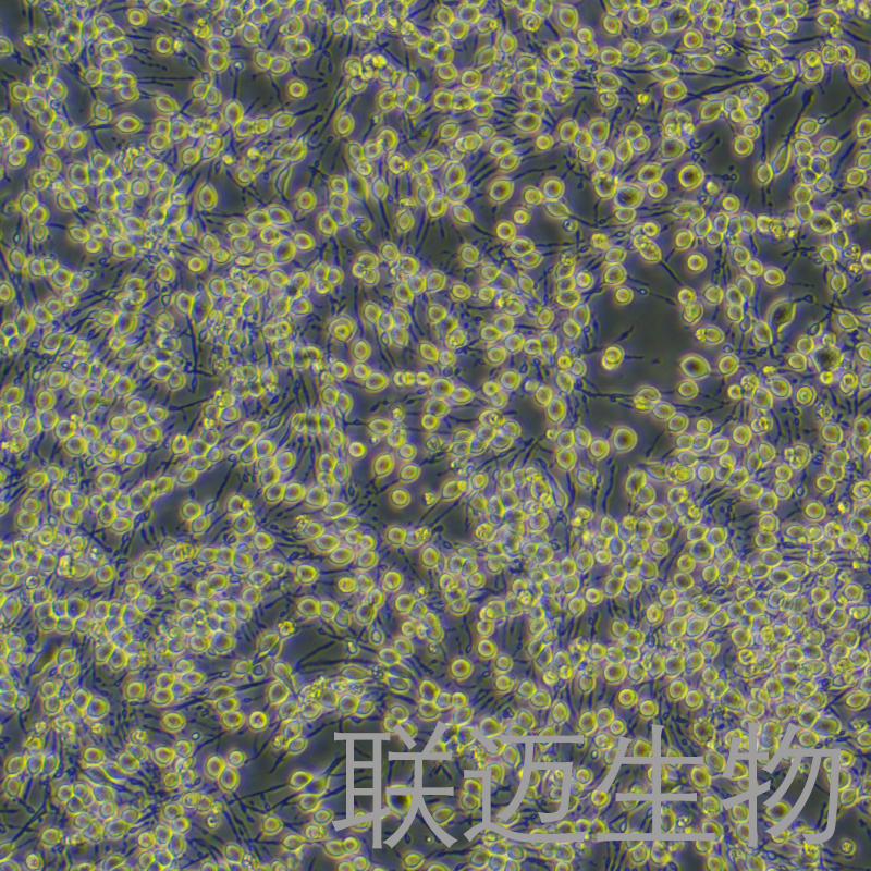 RBL-2H3细胞（大鼠嗜碱性细胞白血病细胞）LM8C0196