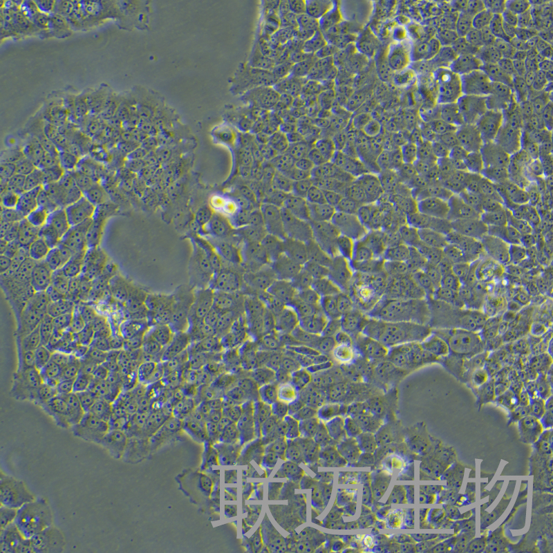 ZR-75-30细胞（乳腺癌细胞）LM8C0248