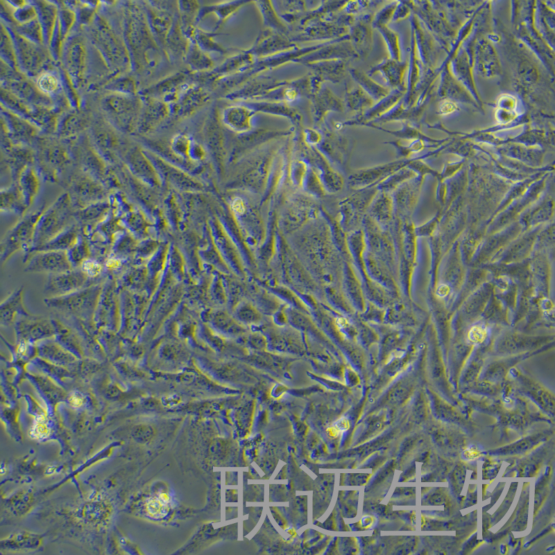 Saos-2细胞（成骨肉瘤细胞STR鉴定正确）LM8C0207