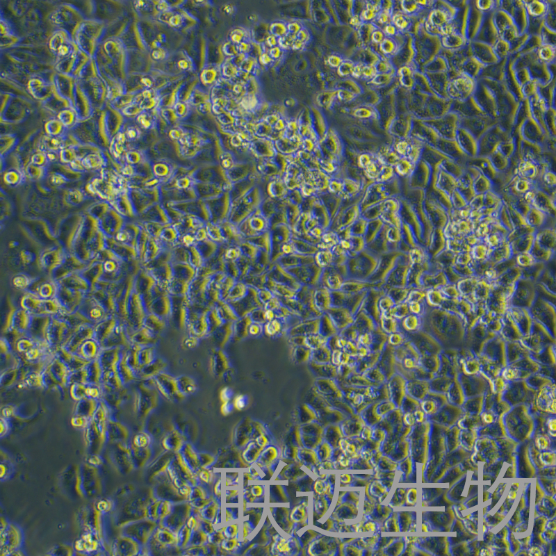 SK-BR-3[SKBR3]细胞（乳腺腺癌细胞STR鉴定正确）LM8C0223