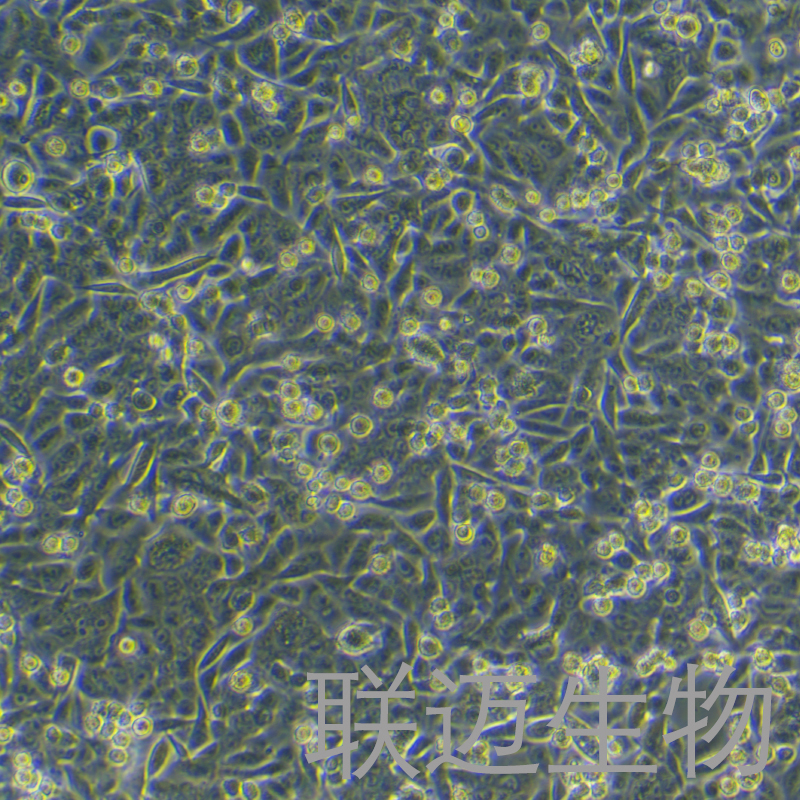 SW480[SW-480]细胞（结肠癌细胞STR鉴定正确）LM8C0227