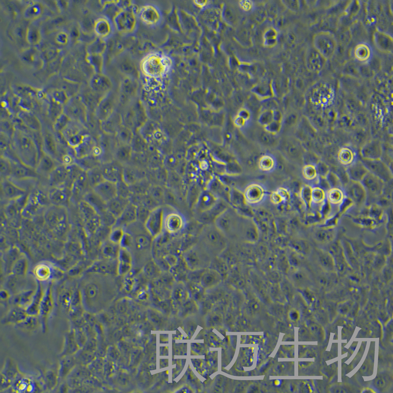 Ishikawa细胞（子宫内膜癌细胞STR鉴定正确）LM8C0283