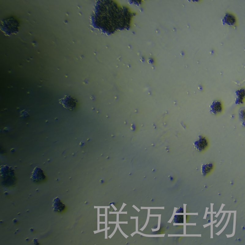 HuT78细胞（T淋巴细胞白血病细胞STR鉴定正确）LM8C0364