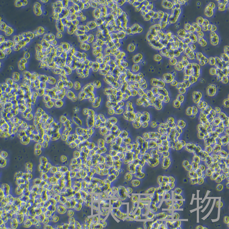 SK-NEP-1细胞（肾母细胞瘤细胞STR鉴定正确）LM8C0442