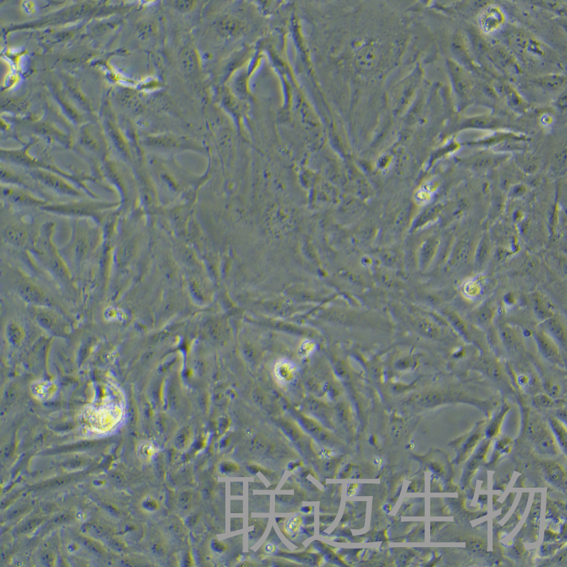 SW1353细胞（软骨肉瘤细胞STR鉴定正确）LM8C0447