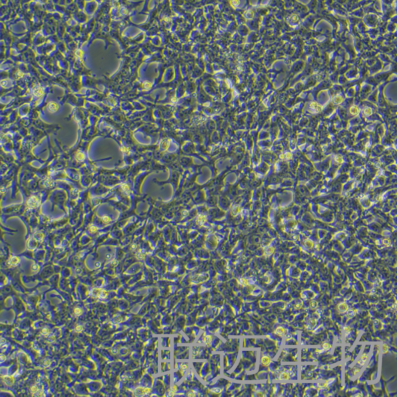 AAV-293细胞（胚肾细胞STR鉴定正确）LM8C0019