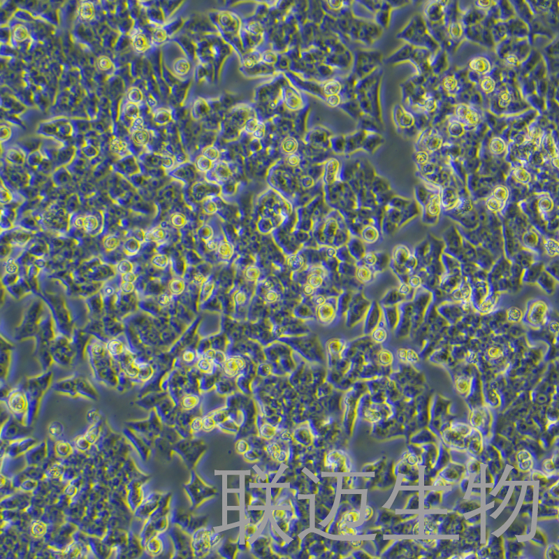 BIU-87细胞（膀胱癌细胞STR鉴定正确）LM8C0035