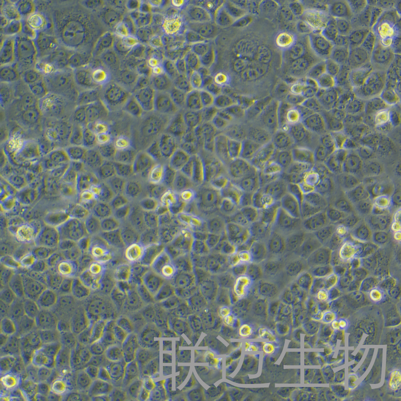 HCC1937细胞（乳腺癌细胞STR鉴定正确）LM8C0093