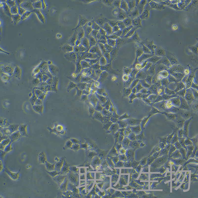 HCC827细胞（非小细胞肺癌细胞STR鉴定正确）LM8C0094