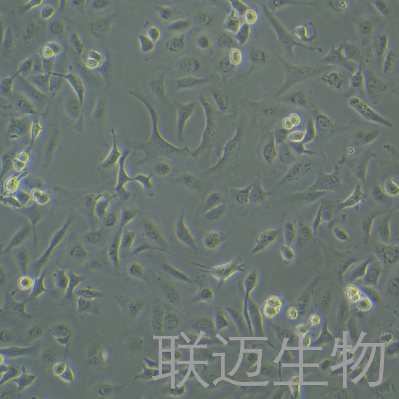 SK-OV-3细胞（卵巢癌细胞STR鉴定正确）LM8C0215