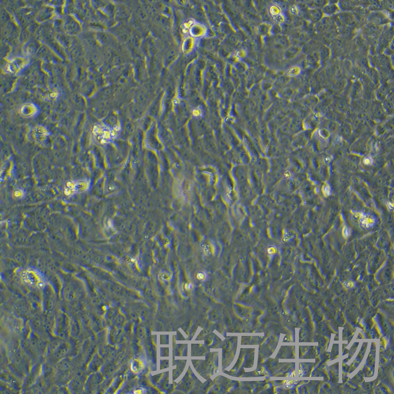 SK-MES-1细胞（肺鳞癌细胞STR鉴定正确）LM8C0213