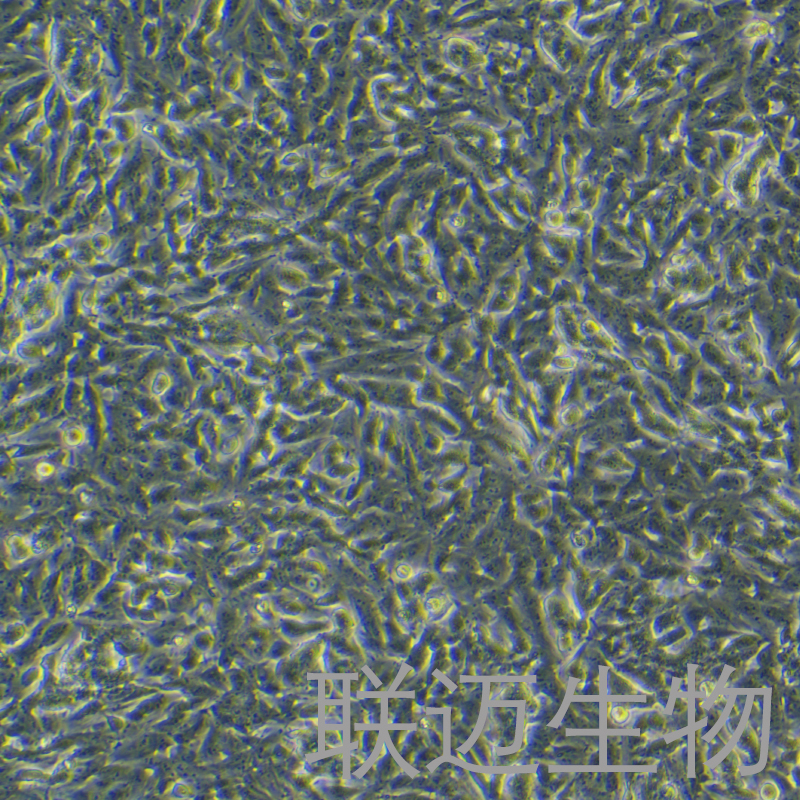 SH-SY5Y[SHSY-5Y]细胞（神经母细胞瘤细胞STR鉴定正确）LM8C0208