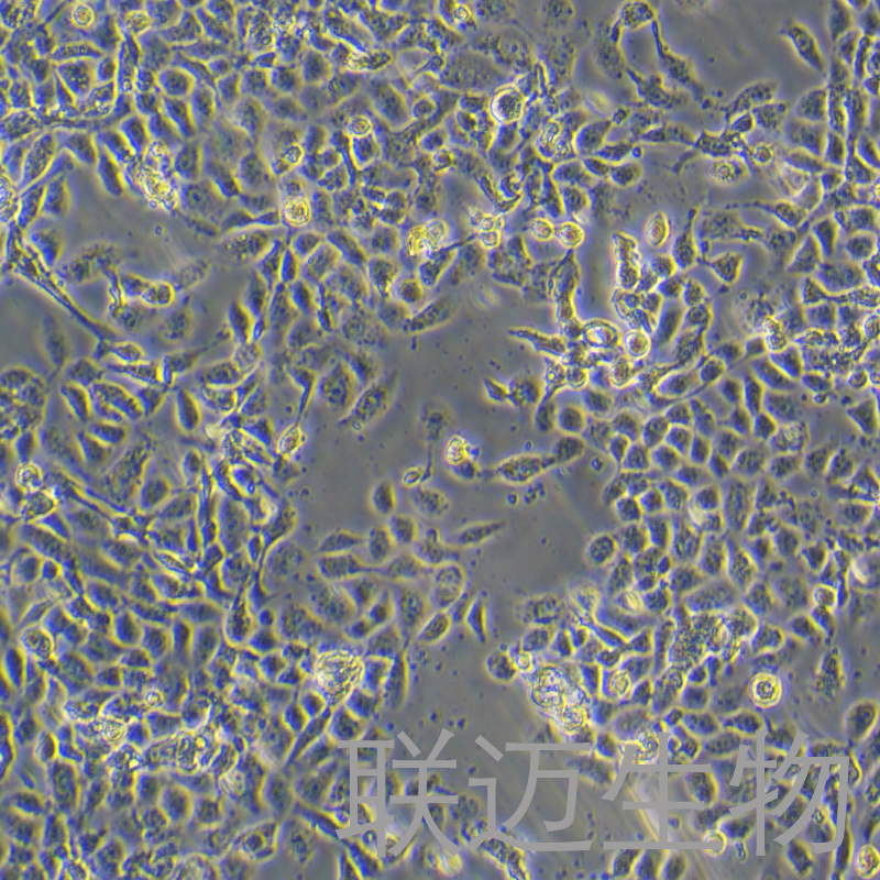 RL95-2细胞（子宫内膜癌细胞STR鉴定正确）LM8C0197