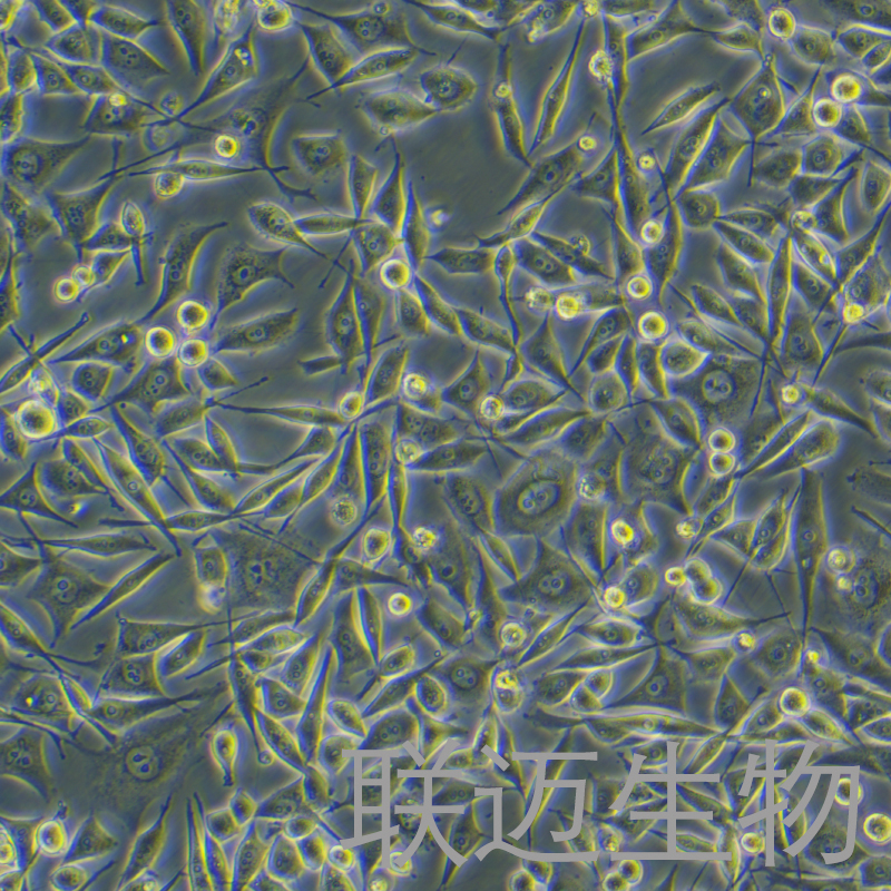 PC-3细胞（前列腺癌细胞STR鉴定正确）LM8C0185