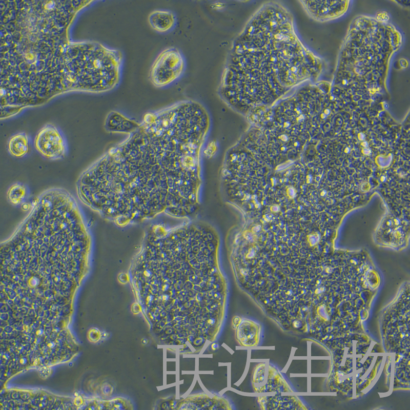 NCI-N87[N87]细胞（胃癌细胞STR鉴定正确）LM8C0169