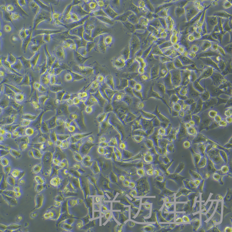 PANC-1细胞（胰腺癌细胞STR鉴定正确）LM8C0184