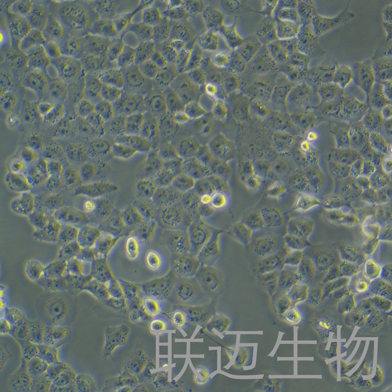 NCI-H1299细胞（非小细胞肺癌细胞STR鉴定正确）LM8C0165