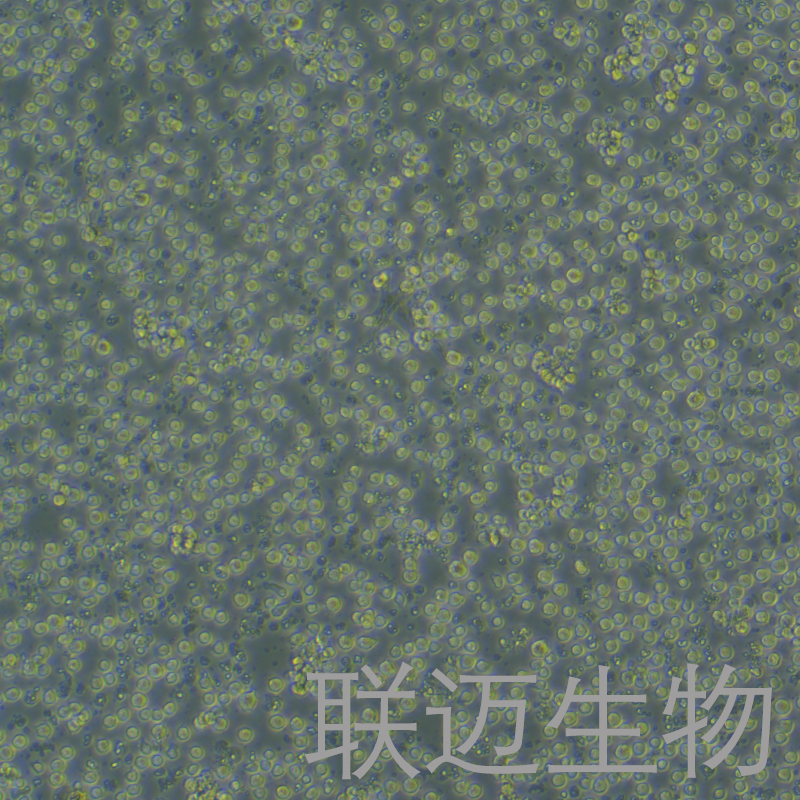 Jurkat,CloneE6-1细胞（T淋巴细胞白血病细胞STR鉴定正确）LM8C0129