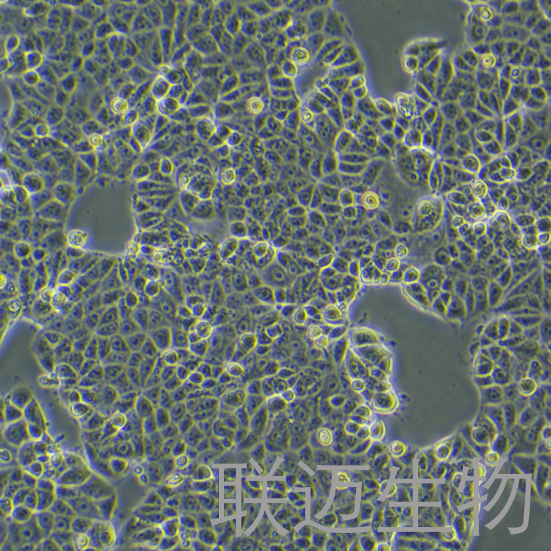 MCF7[MCF-7]细胞（乳腺癌细胞STR鉴定正确）LM8C0149