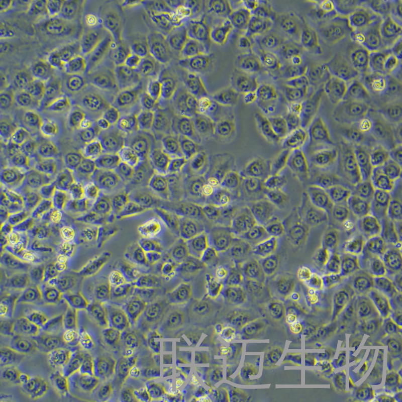 HT-1080[HT1080]细胞（纤维肉瘤细胞STR鉴定正确）LM8C0117