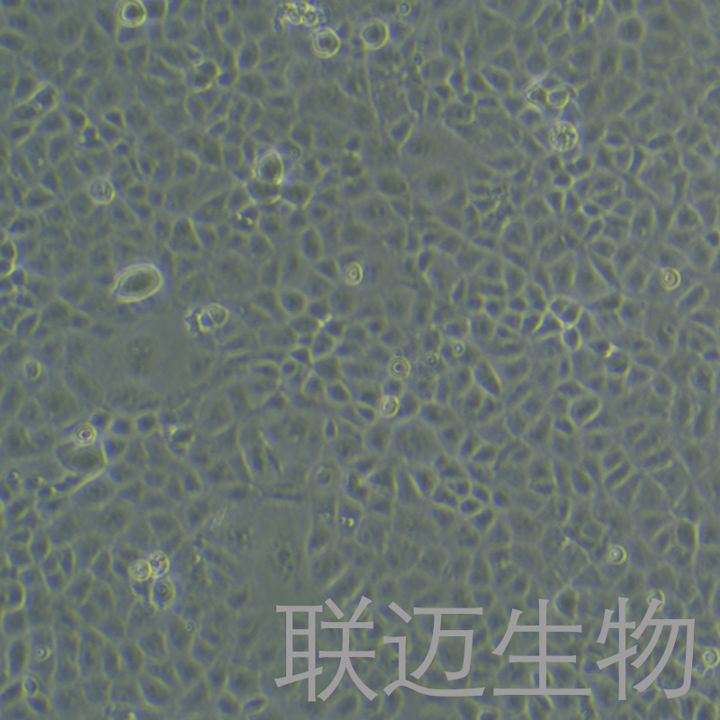 HK-2细胞（肾皮质近曲小管上皮细胞STR鉴定正确）LM8C0109