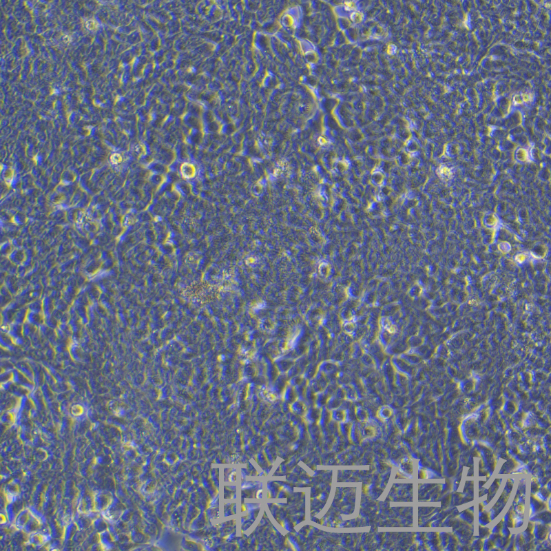 HT-29细胞（结肠癌细胞STR鉴定正确）LM8C0118