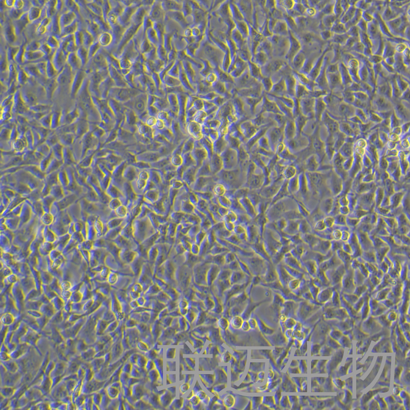 C918细胞（眼脉络黑色素瘤细胞STR鉴定正确）LM8C0264