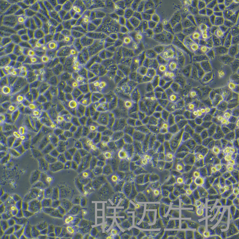 MDA-MB-468细胞（乳腺癌细胞STR鉴定正确）LM8C0290