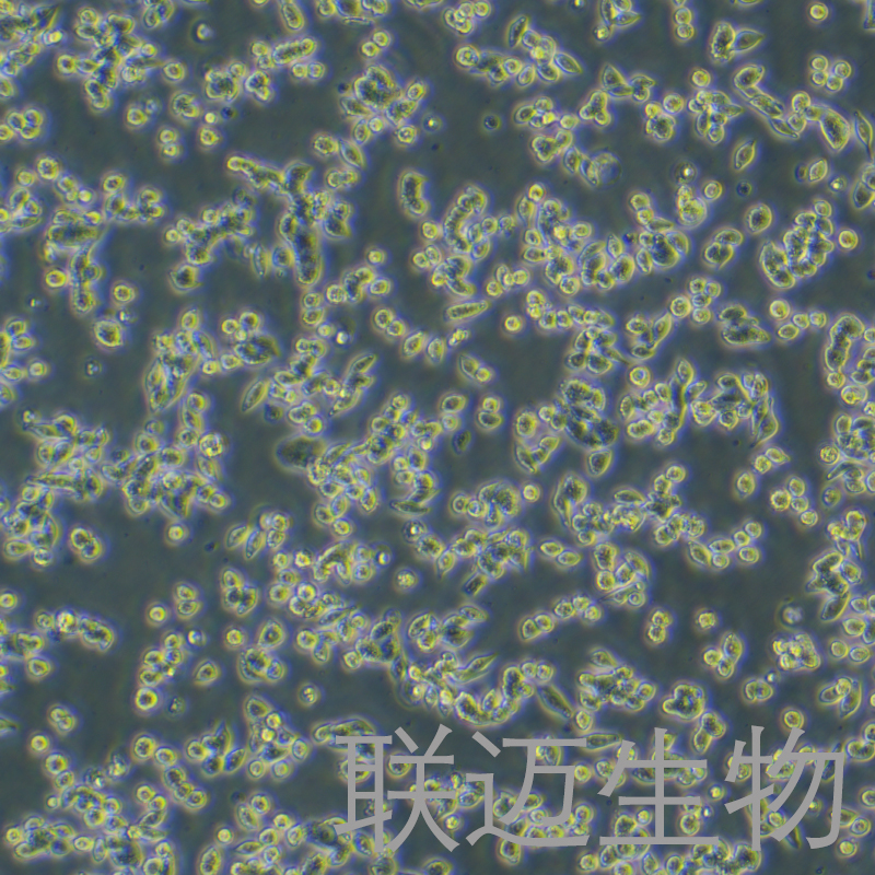 SW620细胞（结肠癌细胞STR鉴定正确）LM8C0225