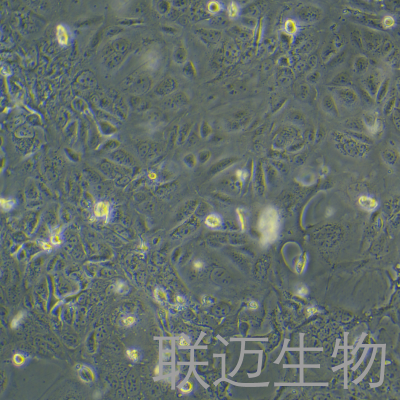 SV-HUC-1细胞（输尿管上皮永生化细胞STR鉴定正确）LM8C0222