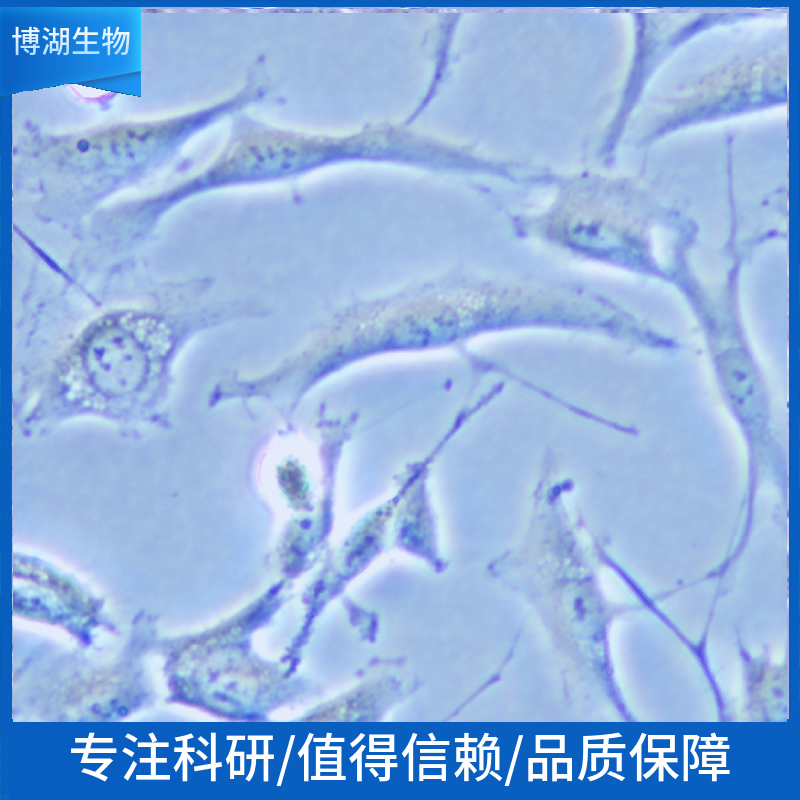 EJ-1[EJ1]人膀胱癌细胞