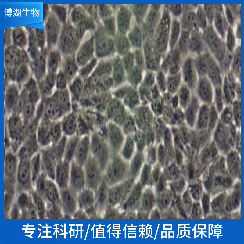 FRO(人未分化甲状腺癌细胞)