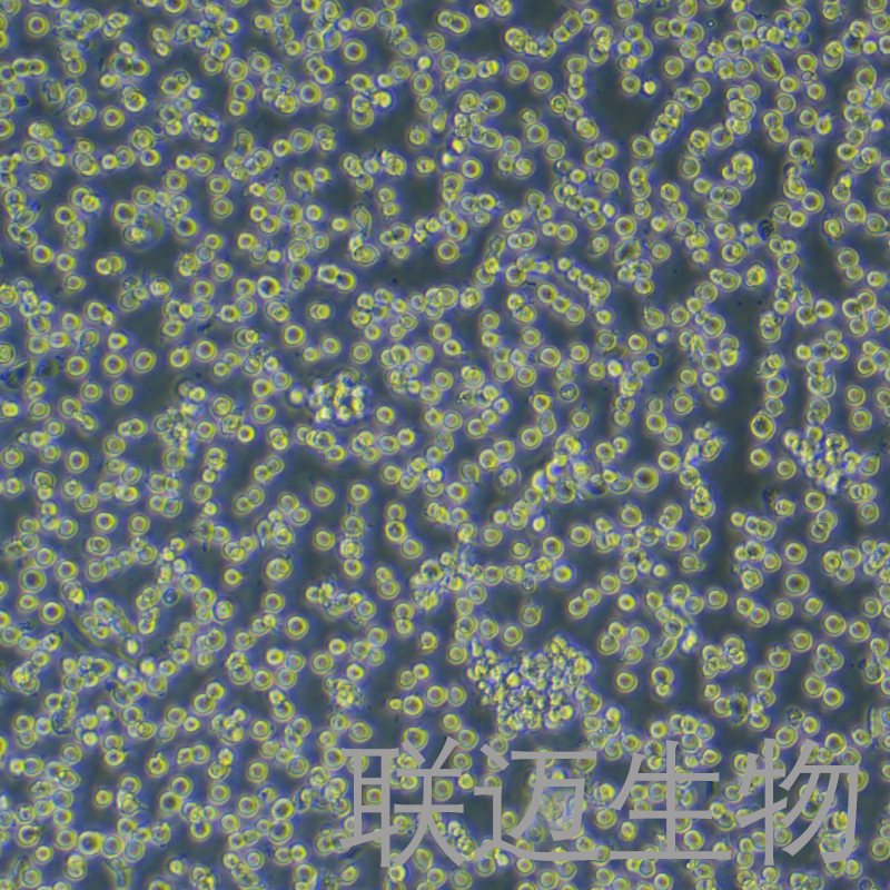 HEL细胞（红白细胞白血病细胞STR鉴定正确）LM8C0280