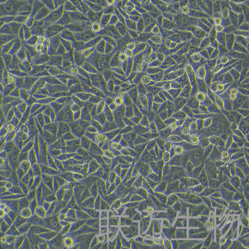 PC-3M细胞（前列腺癌细胞STR鉴定正确）LM8C0304