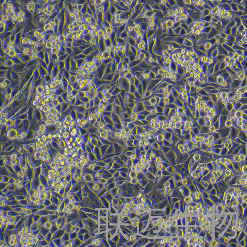Calu-6细胞（退行性癌细胞STR鉴定正确）LM8C0327