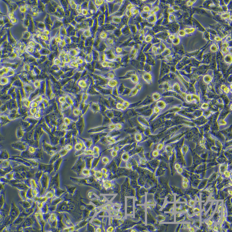 UM-UC-3细胞（膀胱移行细胞癌STR鉴定正确）LM8C0463