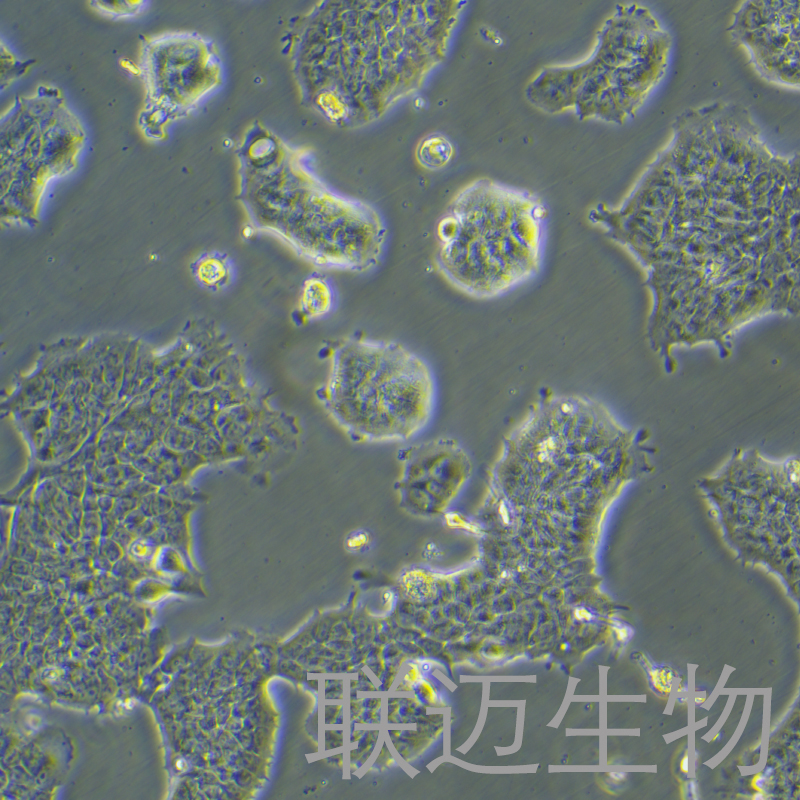 RT4细胞（膀胱移行细胞乳头瘤细胞STR鉴定正确）LM8C0431