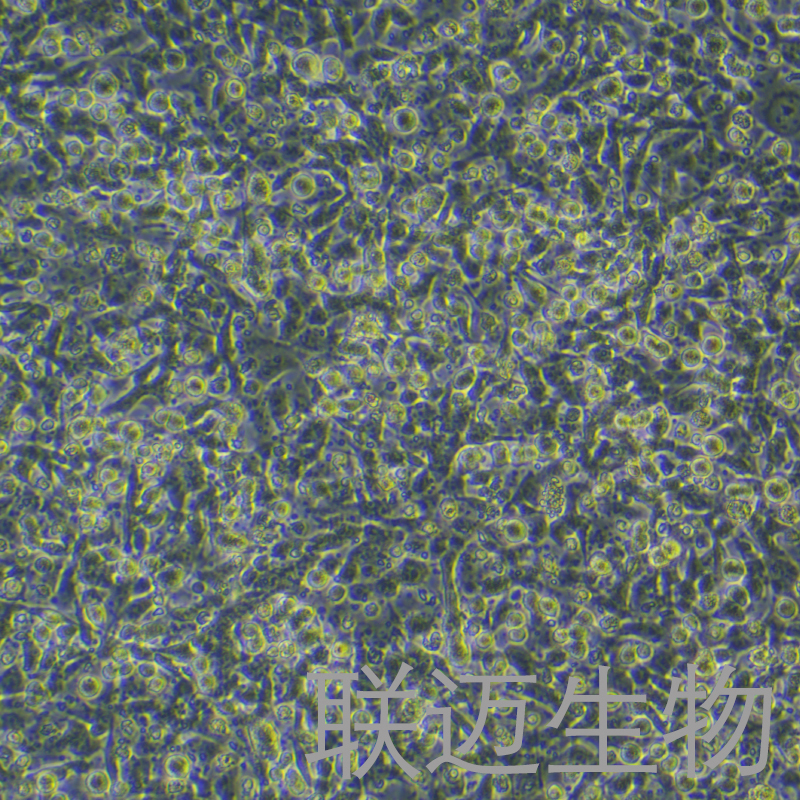 HTR-8/Svneo细胞（绒毛膜滋养层细胞）LM8C0599