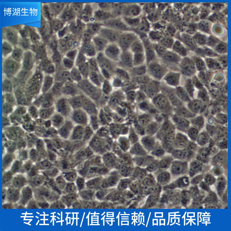 C6+LUC大鼠脑胶质瘤细胞绿色荧光标记