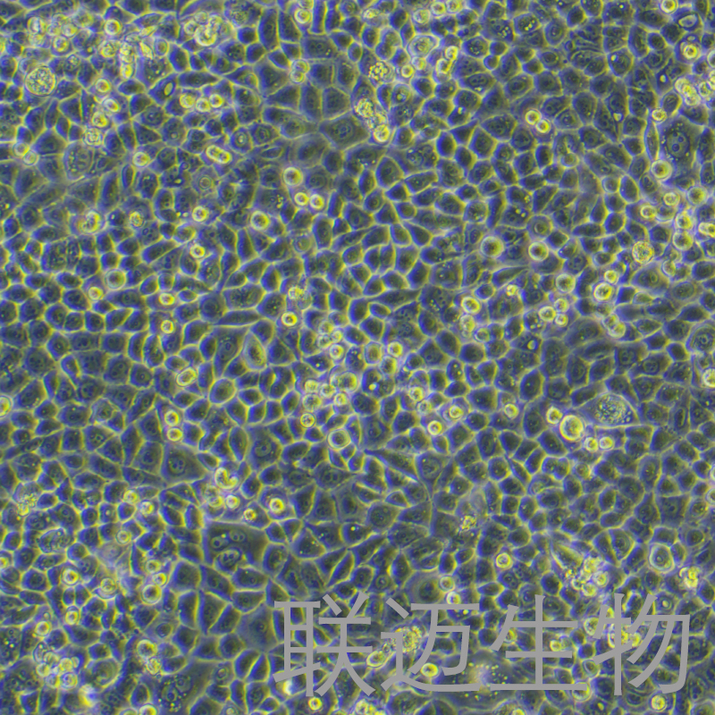 PC-9细胞（肺癌细胞STR鉴定正确）LM8C0671