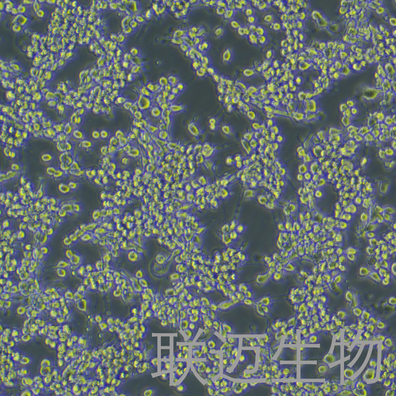 MFC细胞（小鼠胃癌细胞）LM8C0156