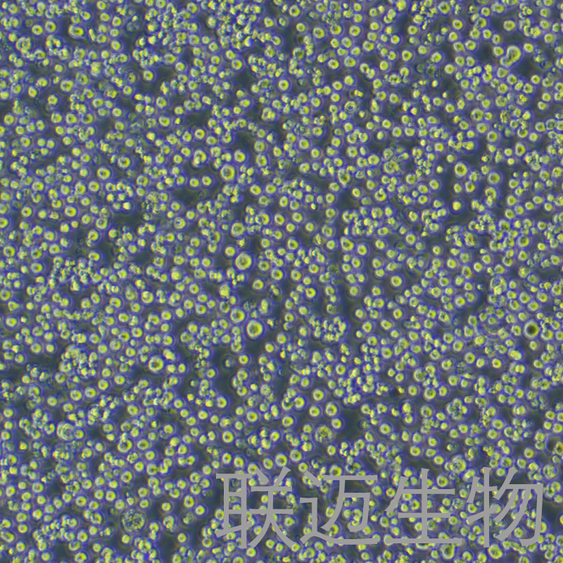 H22细胞（小鼠肝癌细胞）LM8C0341