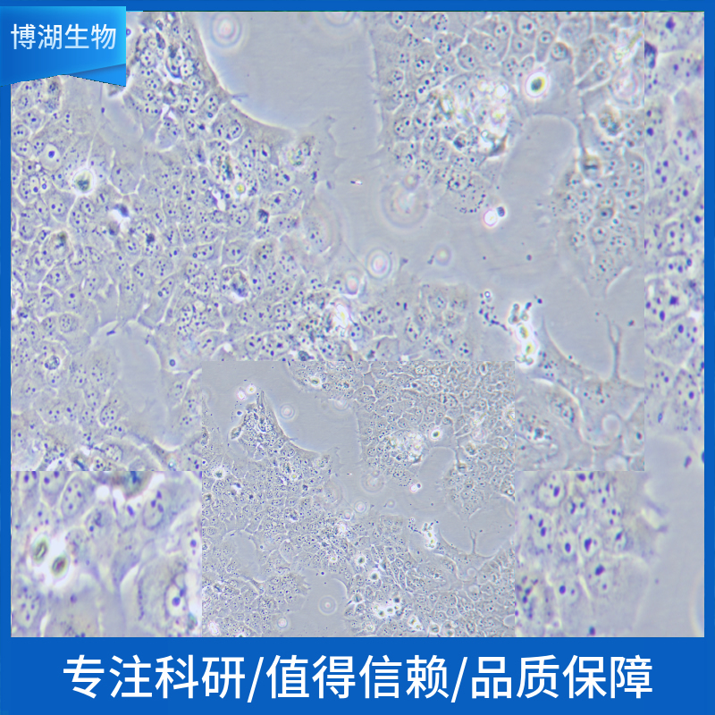 Jurkat（clone E6-1）人T淋巴细胞白血病细胞