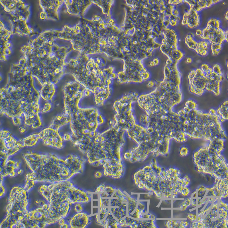 T84细胞（结肠腺癌肺转移细胞STR鉴定正确）LM8C0229