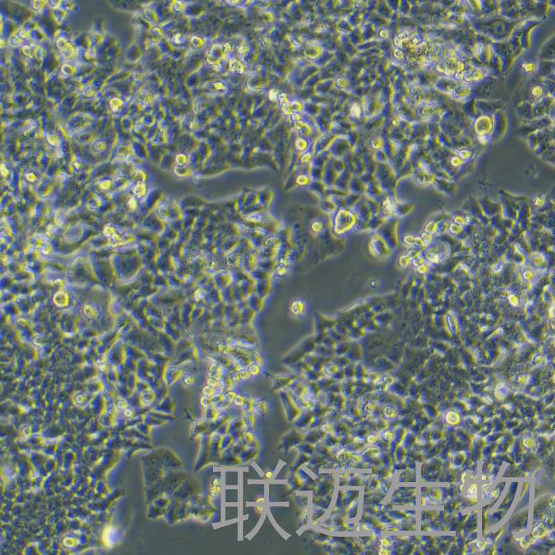 NCI-H520细胞（肺鳞癌细胞STR鉴定正确）LM8C0402