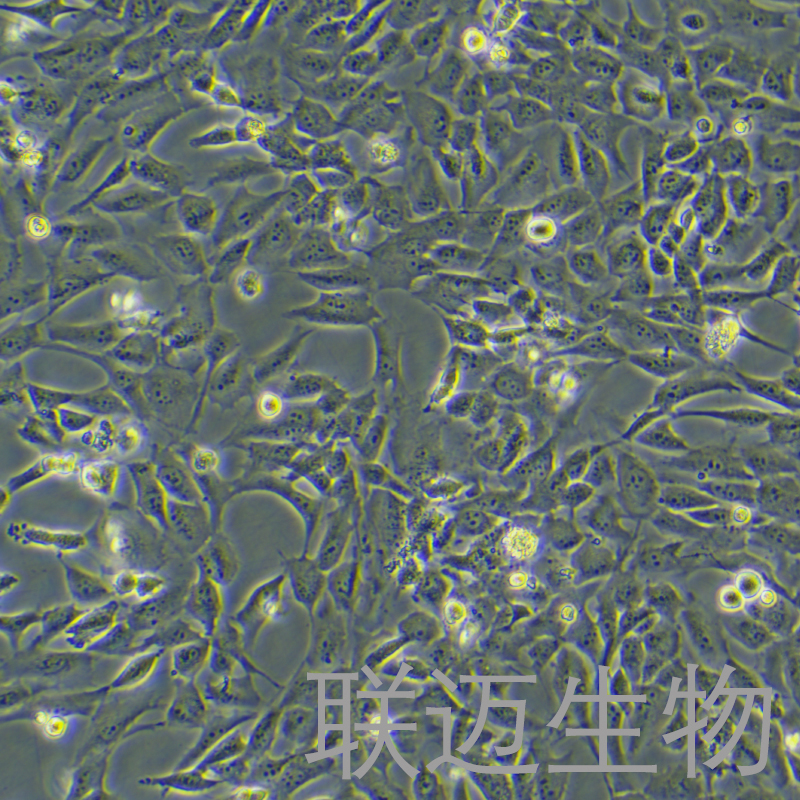WPMY-1细胞（正常前列腺基质永生化细胞STR鉴定正确）LM8C0467