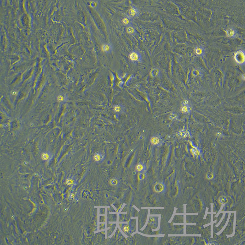 SNU-387细胞（肝癌细胞STR鉴定正确）LM8C0612